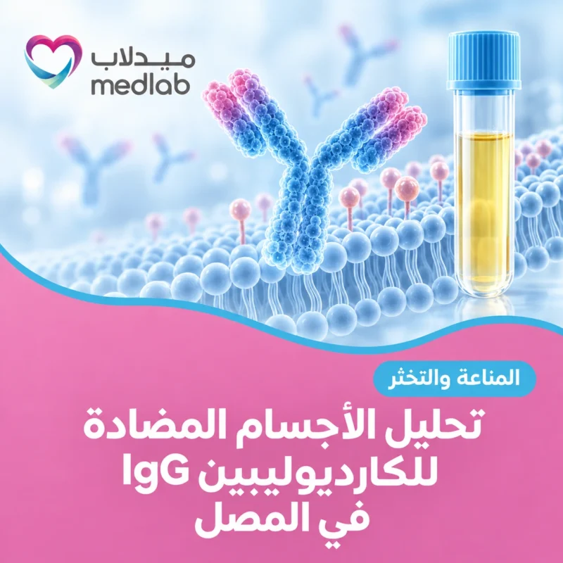 تحليل الأجسام المضادة للكارديوليبين IgG في المصل