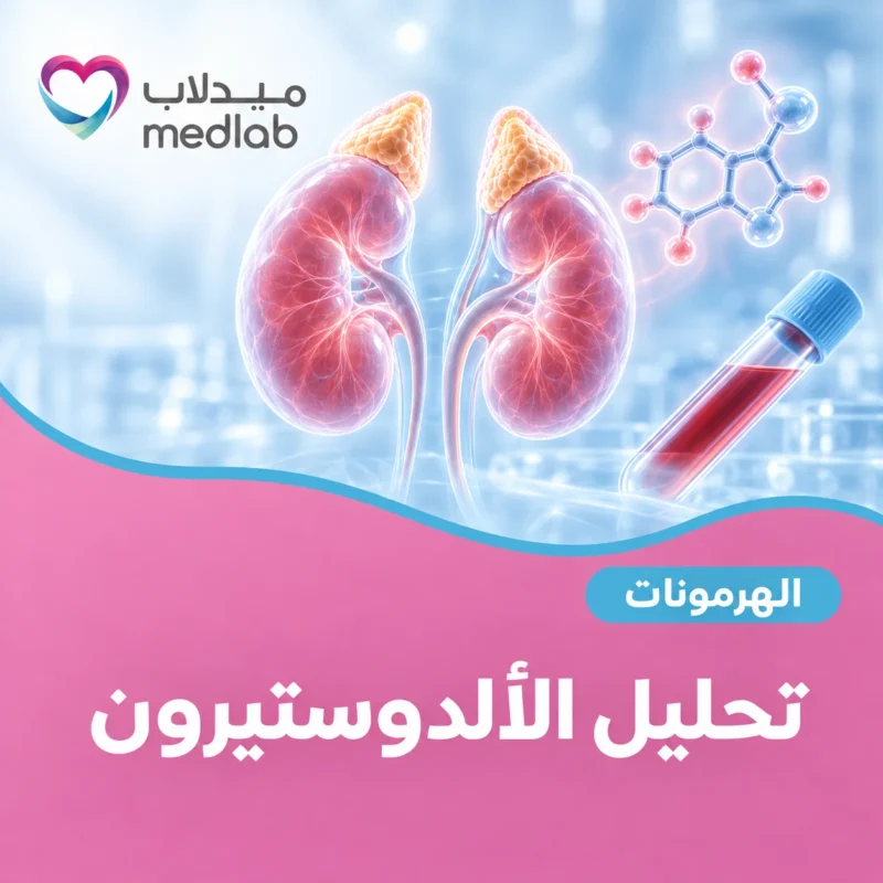تحليل الألدوستيرون