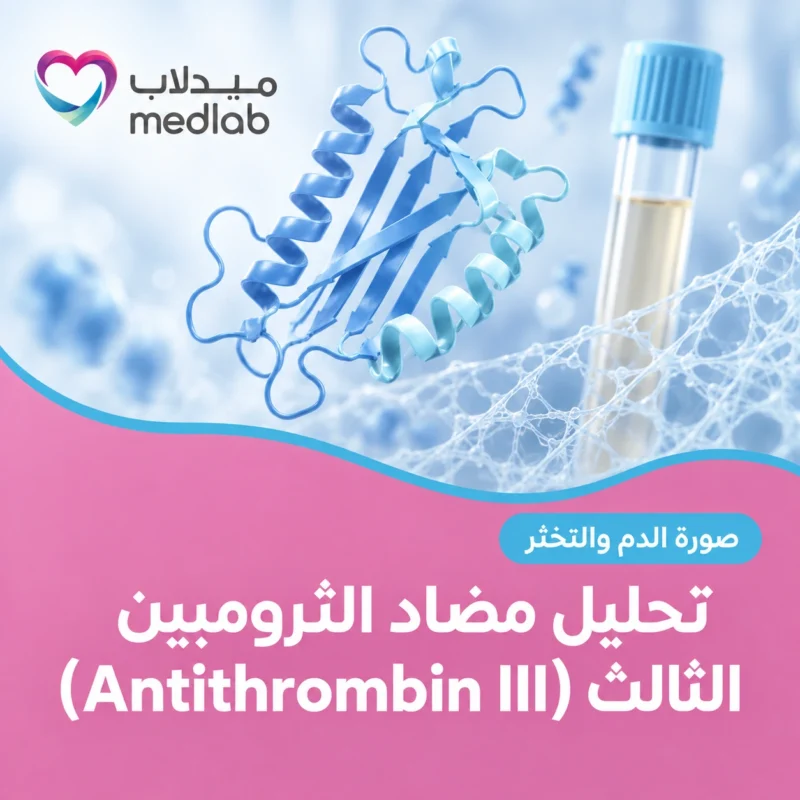 تحليل مضاد الثرومبين الثالث (Antithrombin III)
