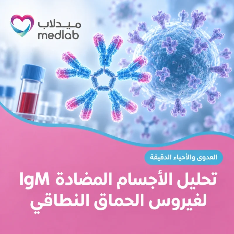 تحليل الأجسام المضادة IgM لفيروس الحماق النطاقي