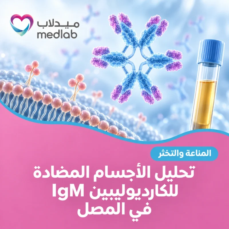 تحليل الأجسام المضادة للكارديوليبين IgM في المصل