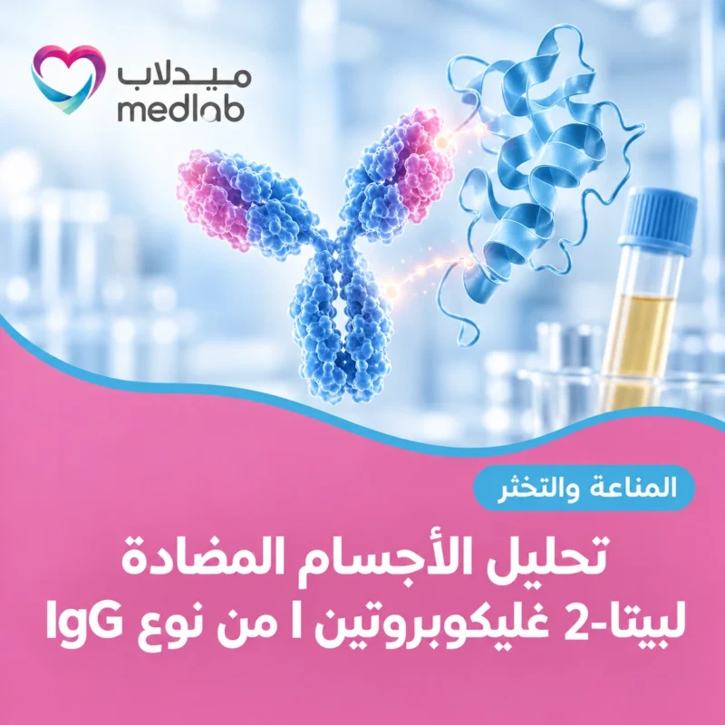 تحليل الأجسام المضادة لبيتا-2 غليكوبروتين I من نوع IgG