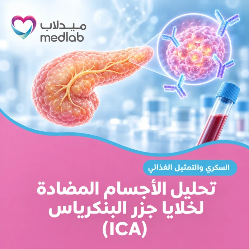تحليل الأجسام المضادة لخلايا جزر البنكرياس (ICA)