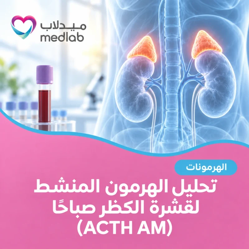 تحليل الهرمون المنشط لقشرة الكظر صباحًا (ACTH AM)