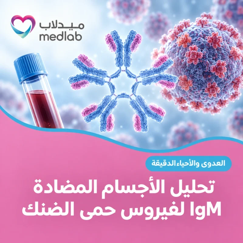 تحليل الأجسام المضادة IgM لفيروس حمى الضنك