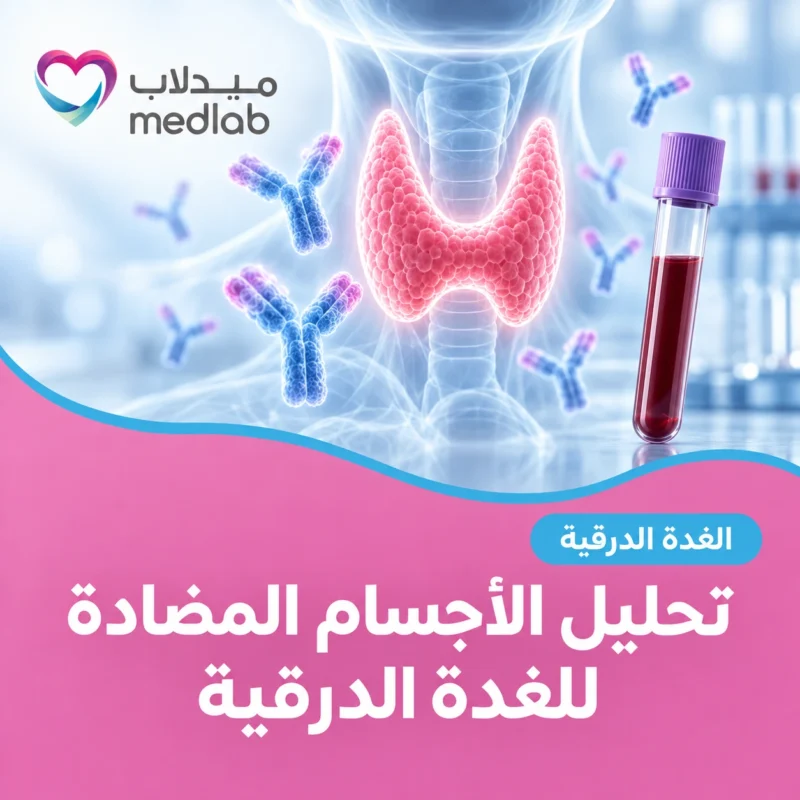 تحليل الأجسام المضادة للغدة الدرقية