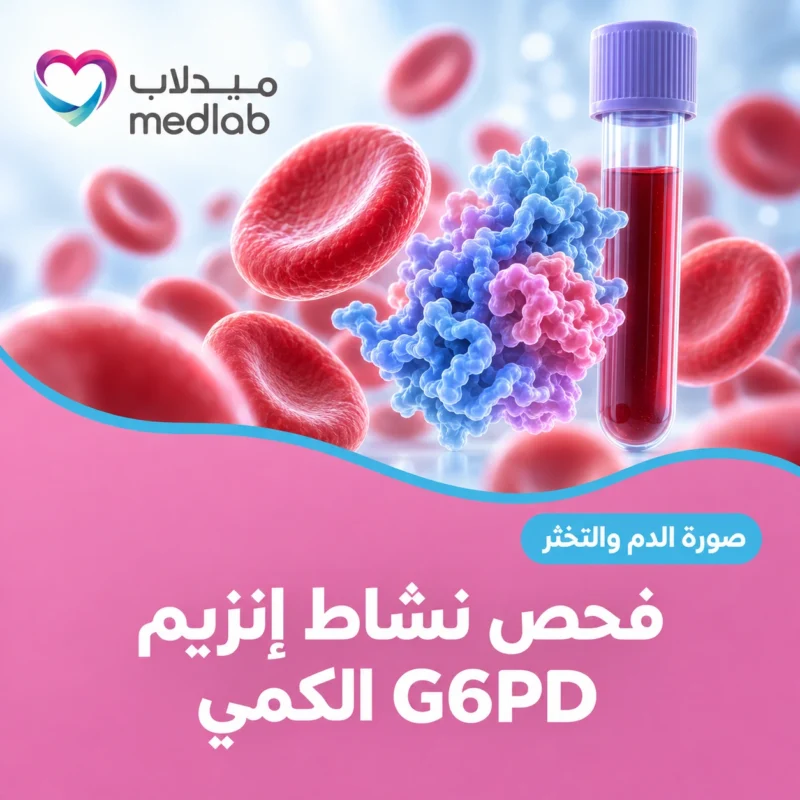 فحص نشاط إنزيم G6PD الكمي