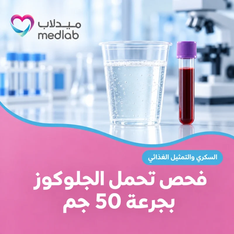 فحص تحمل الجلوكوز بجرعة 50 جم